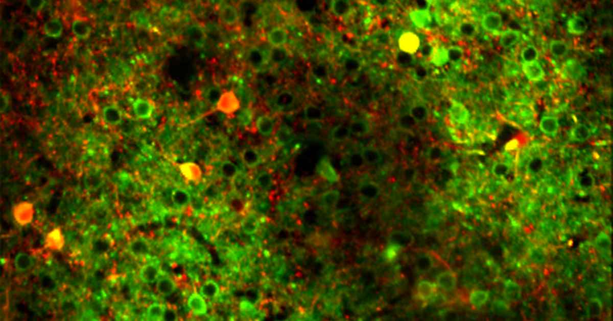 Cognitive and Systems Neuroscience - SILS - University of Amsterdam