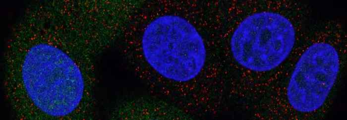 Image of fluorescent cell nuclei