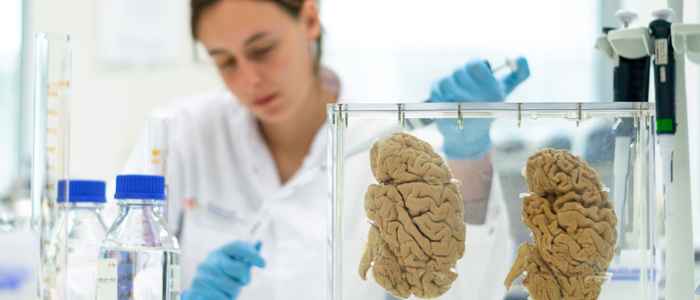 Brain preparation in the lab of the Dutch Brain Bank (photo: Vera van de Donk)