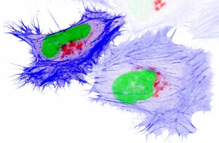 Fluorescent cancercells