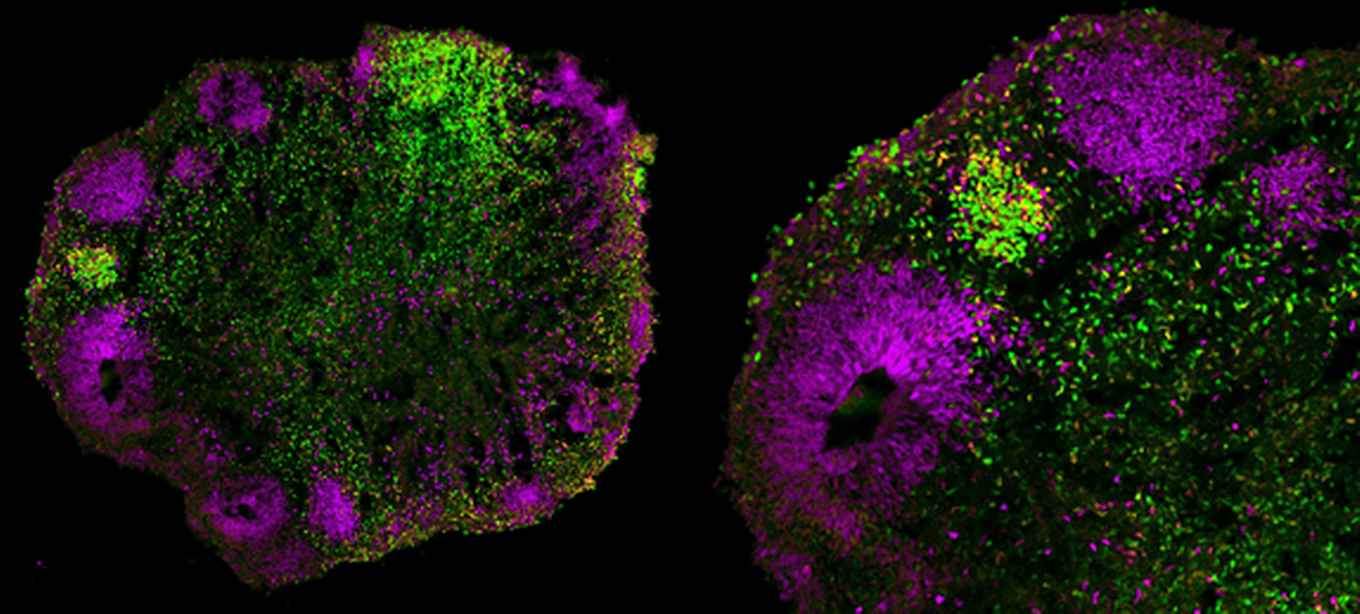 Cortical Brain Organoids